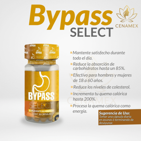 Bypass Select - Image 2